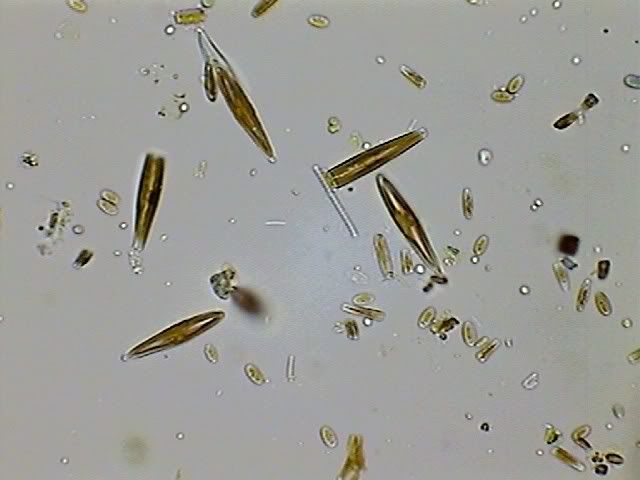 Mixed Diatoms