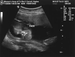 081126 face
