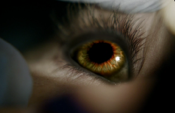 Tyler's eye